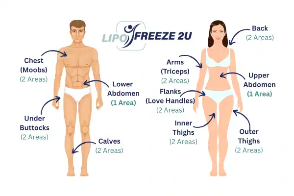 Areas you can have fat freezing treatment Buckingham