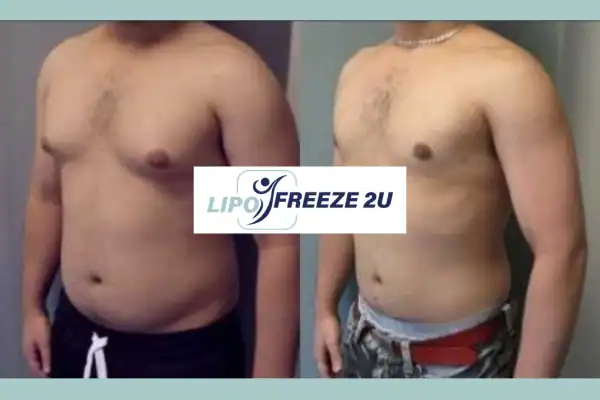 How Long Does It Take to See Results Buckingham?