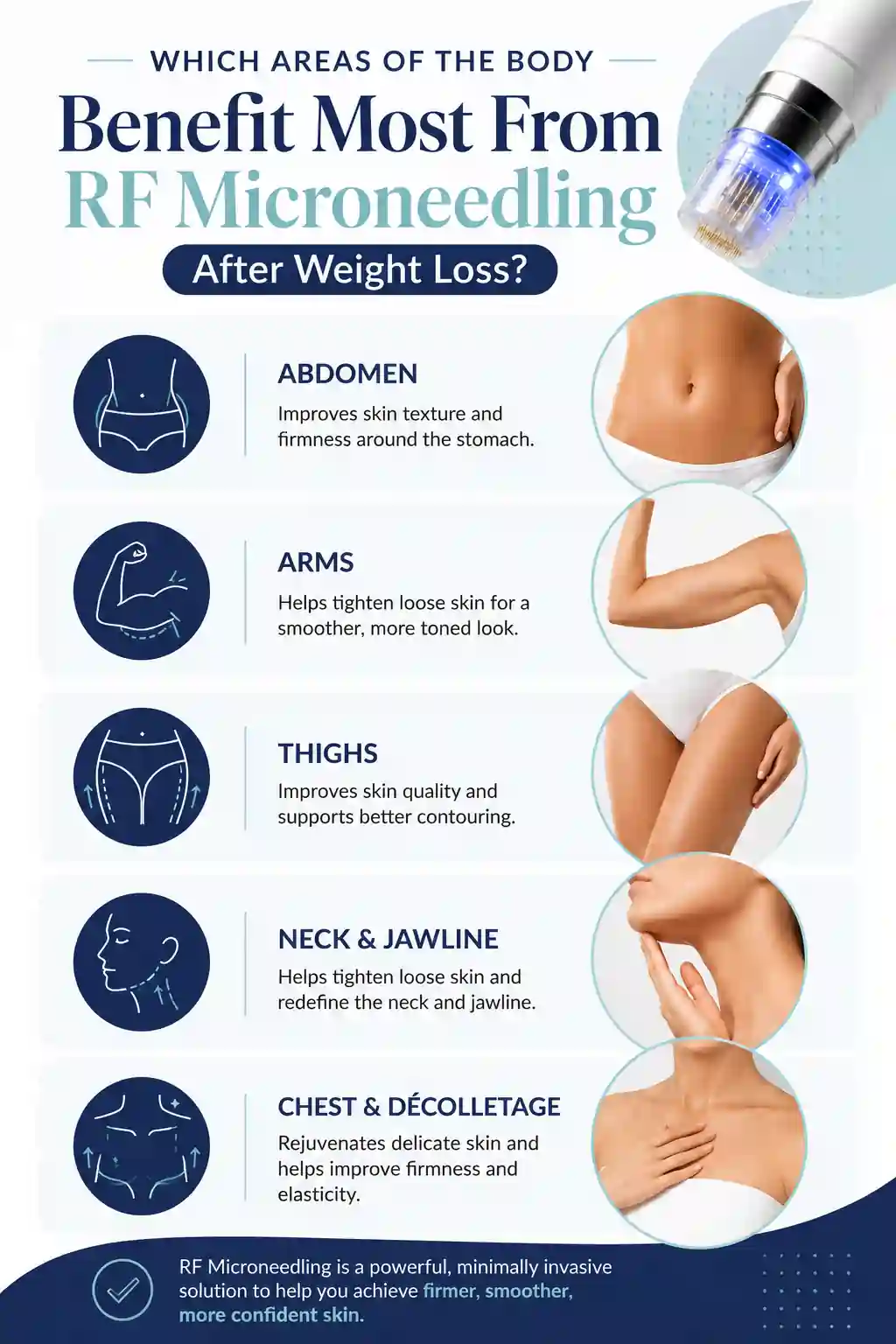 Which Areas of the Body Benefit Most From RF Microneedling After Weight Loss Buckingham